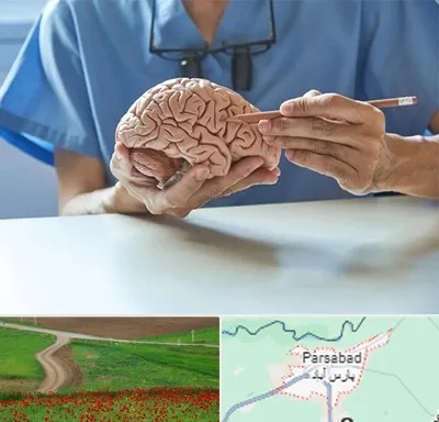 دکتر نورولوژی در پارس آباد