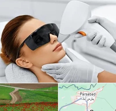 مرکز لیزر مو در پارس آباد