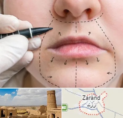 عمل سانترال لب در زرند