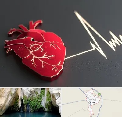 متخصص الکتروفیزیولوژی در خورموج