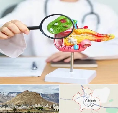 جراح سرطان پانکراس در گراش
