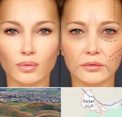متخصص زیبایی چشم در فارسان