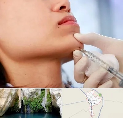 زاویه سازی صورت در خورموج