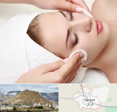 مرکز فیشیال در گراش