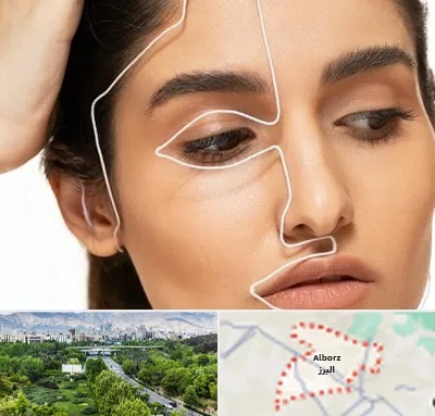 عمل بینی اقساطی در البرز
