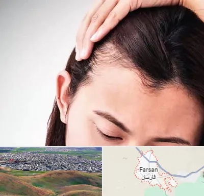 کاشت مو بانوان در فارسان