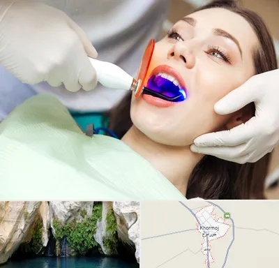 دندانپزشکی بدون درد در خورموج