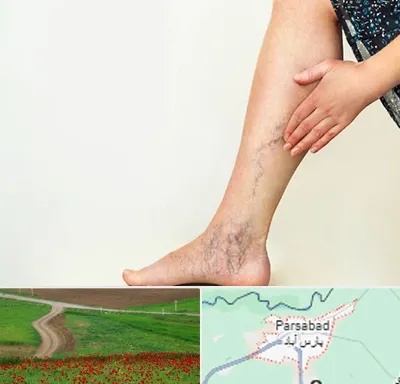 دکتر واریس در پارس آباد