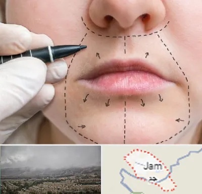 عمل سانترال لب در جم