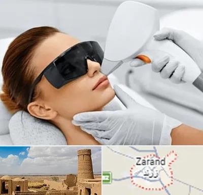 مرکز لیزر مو در زرند