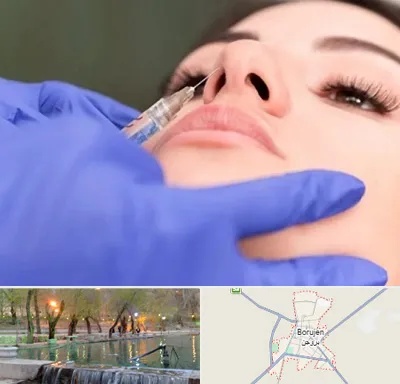 هیالاز در بروجن