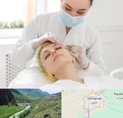 کلینیک زیبایی در اشنویه