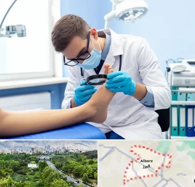درمان زخم پای دیابتی در البرز