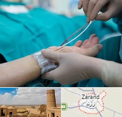 آنژیوگرافی در زرند
