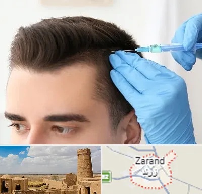 مزوتراپی مو در زرند