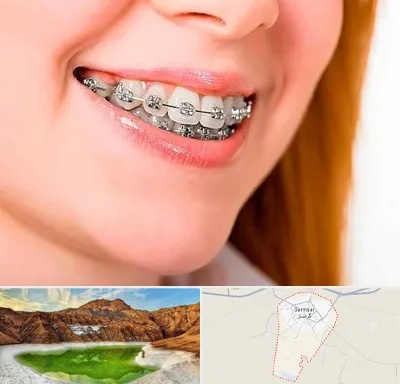 ارتودنسی ارزان در گرمسار
