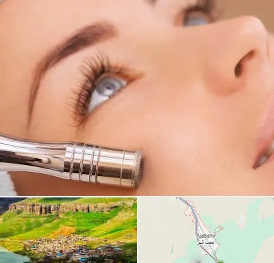 میکرودرم در عجب شیر