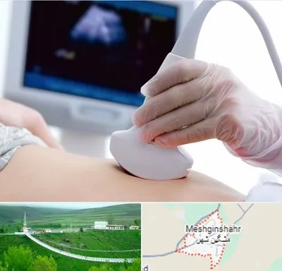 سونوگرافی در مشگین شهر