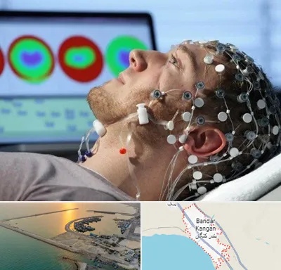 مرکز نوار مغز در بندر کنگان
