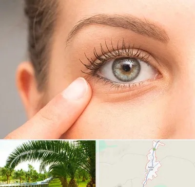 جراح پف چشم در کهنوج