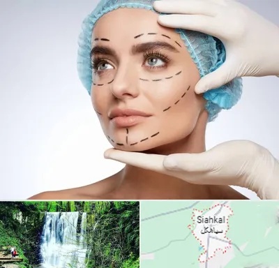 جراحی زیبایی در سیاهکل