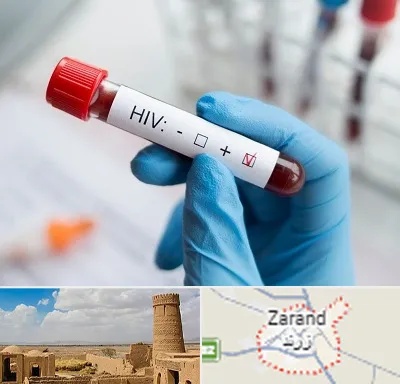 آزمایشگاه ایدز در زرند