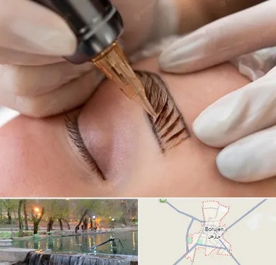 میکروبلیدینگ در بروجن