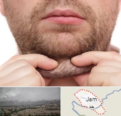 ساکشن غبغب در جم