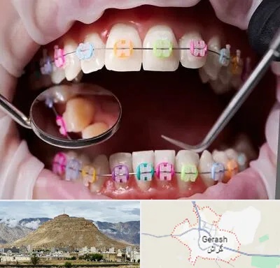 متخصص ارتودنسی در گراش