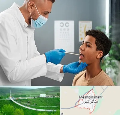 دکتر سرطان دهان در مشگین شهر
