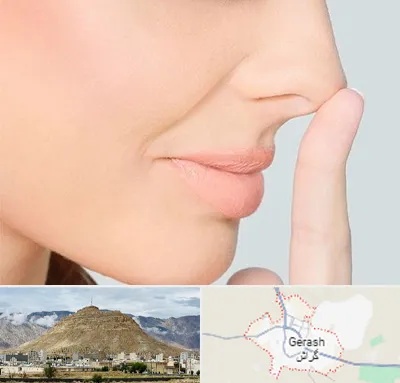 عمل تیپ پلاستی بینی در گراش