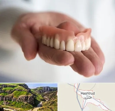 لیفت لثه با لیزر در هشترود