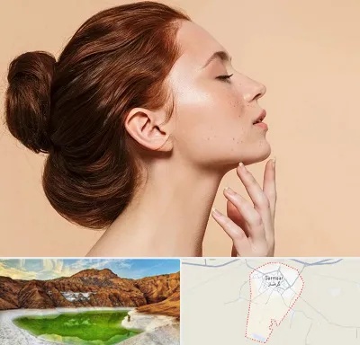 جراحی غبغب در گرمسار