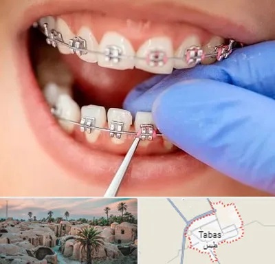 مرکز ارتودنسی دندان در طبس