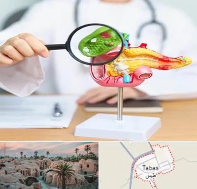 جراح سرطان پانکراس در طبس