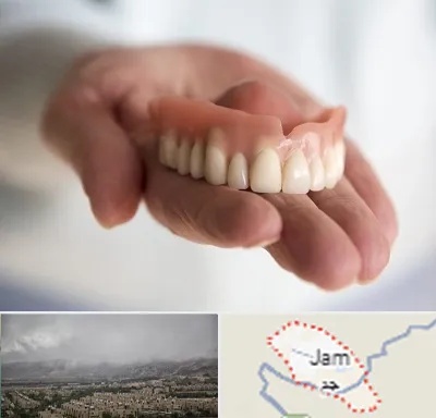 لیفت لثه با لیزر در جم