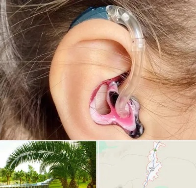 ساخت قالب سمعک در کهنوج