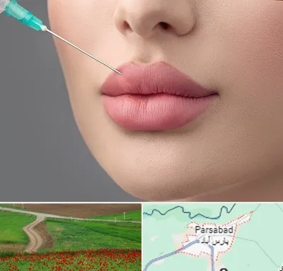 کلینیک ژل لب روسی در پارس آباد