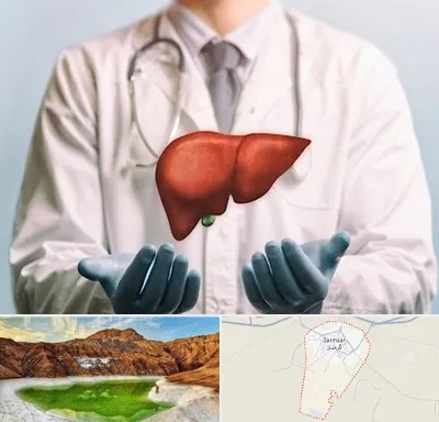 جراح سرطان کبد در گرمسار