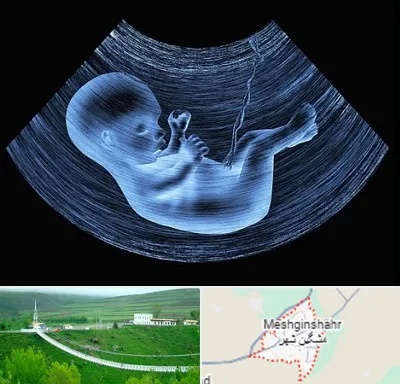 دکتر متخصص غربال گری در مشگین شهر