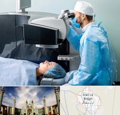 مرکز لیزیک چشم در آران و بیدگل