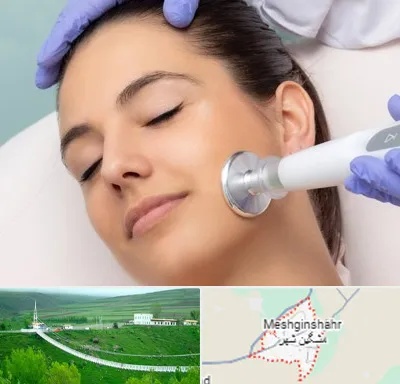 پلاسما جت در مشگین شهر