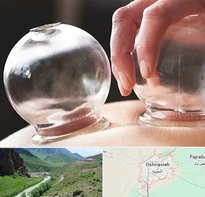 مرکز حجامت در اشنویه
