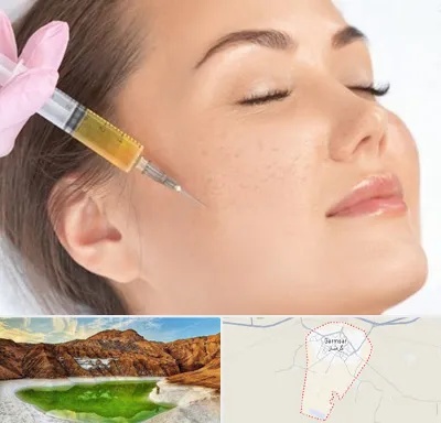 آموزش تزریق ژل و بوتاکس در گرمسار