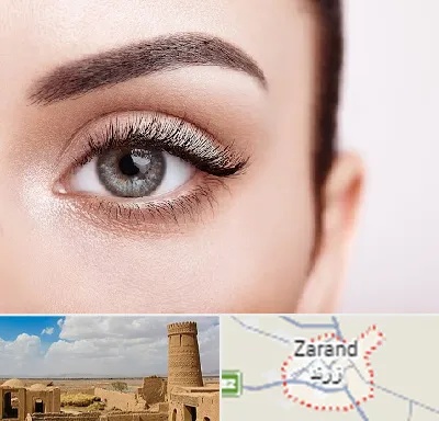 فوق تخصص عنبیه در زرند