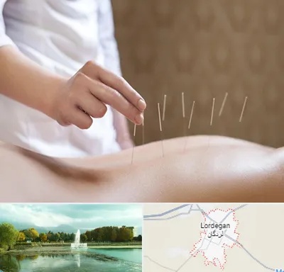 درای نیدلینگ در لردگان