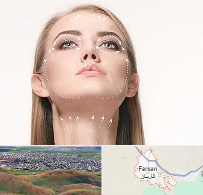لیفت صورت با نخ در فارسان
