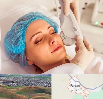 اکسنت در فارسان