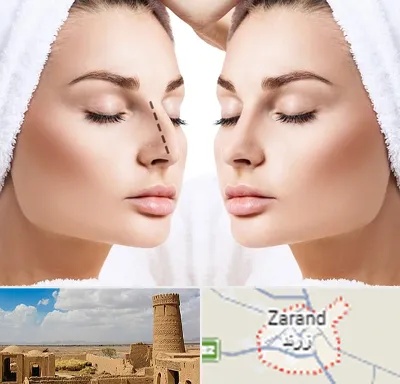 عمل بینی در زرند