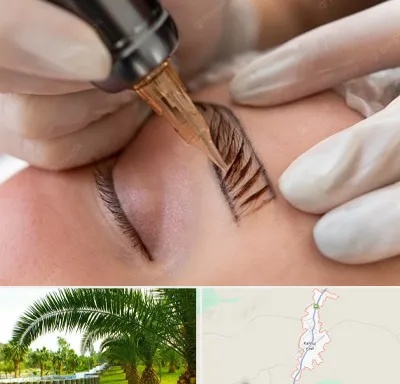 میکروبلیدینگ در کهنوج